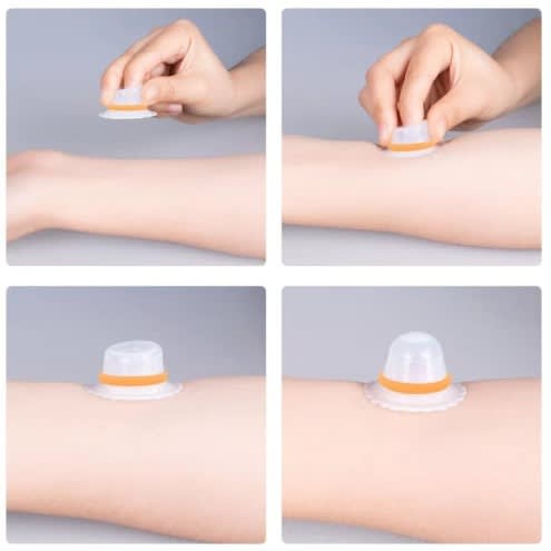 Nip-xtender Nipple Puller & Extender For Flat, Shy Or Inverted Nipples