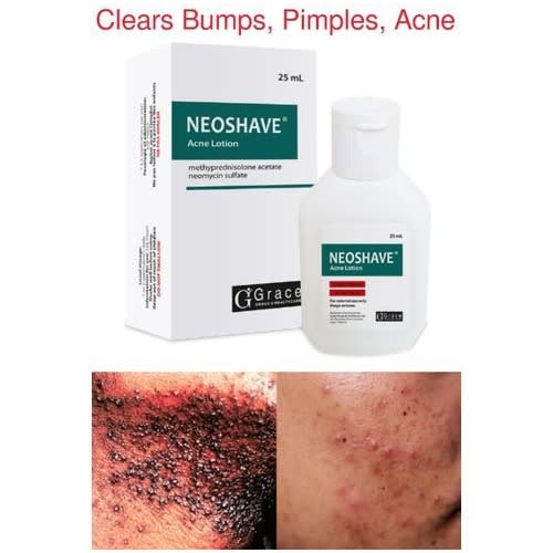 Neo Shave Acne Lotion -Advance Form Of Neomedrol ) For Shave Bumps, Pimples, Acne, Rashes- 25ml