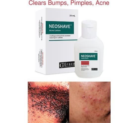 Neo Shave Acne Lotion -Advance Form Of Neomedrol ) For Shave Bumps, Pimples, Acne, Rashes- 25ml