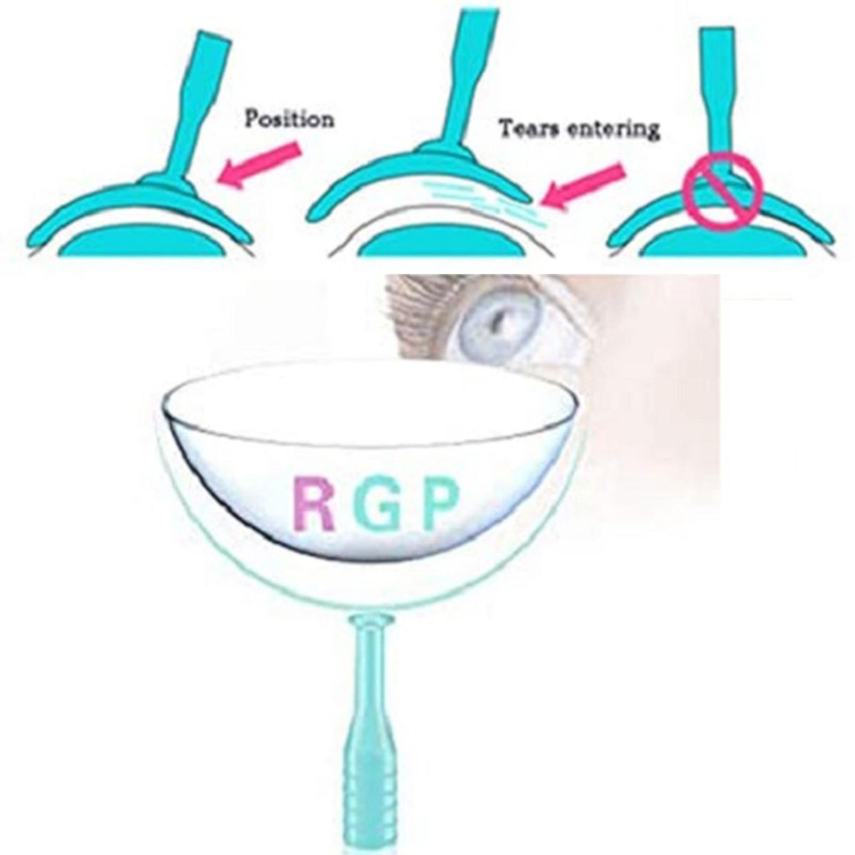 Soft Contact Lens Remover Inserter Extractor Soft Lenses RGP Green