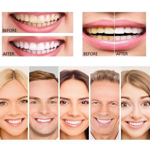 Vitamin C Toothpaste  Whitenin Active Teeth, Gum Protection