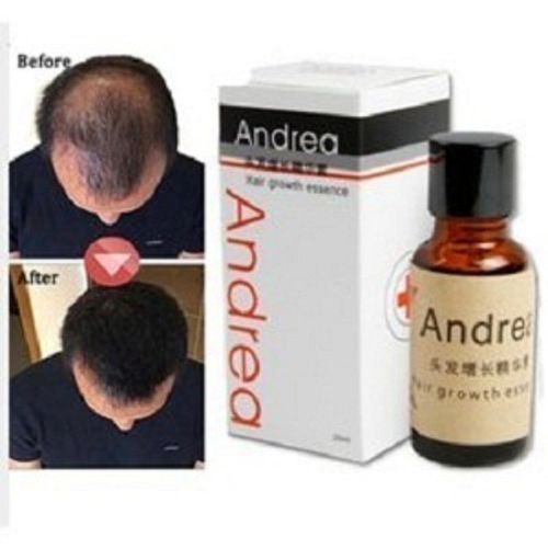 Best Andrea Oil For Hair Growth Treatmen