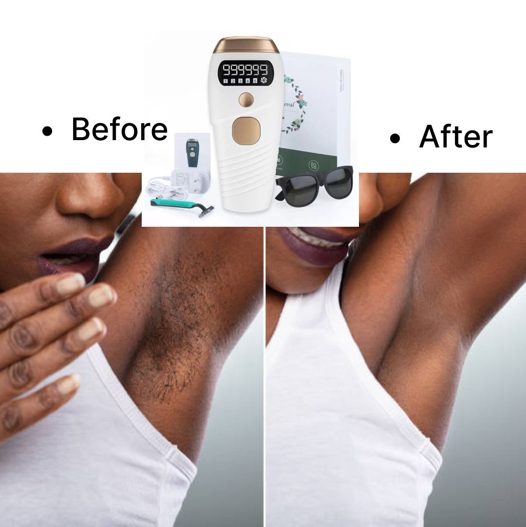 Painless Laser Hair Removal With Quartz For All Skin Type