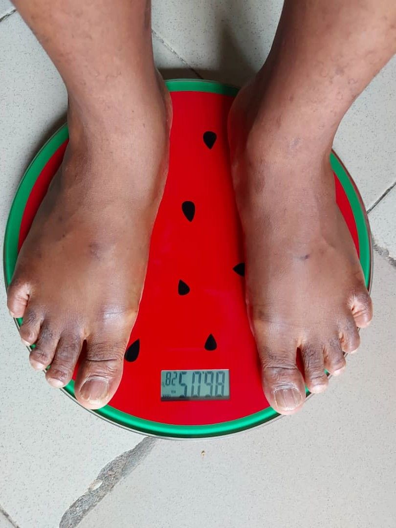DIGITAL BODY SCALE - STEP ON TECHNOLOGY - WATERMELON DESIGN