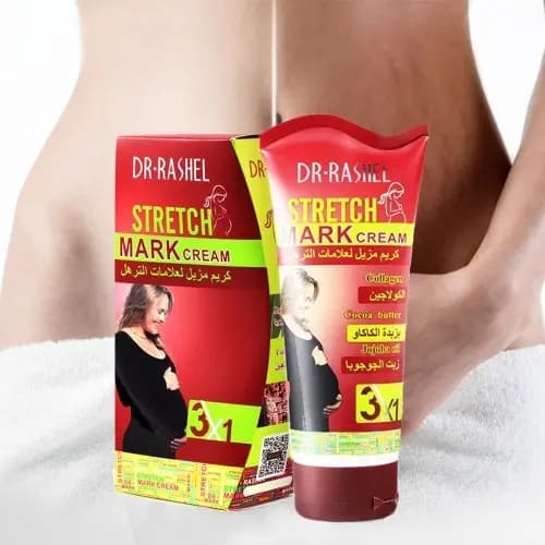 Stretch Mark Remover Cream - 150g