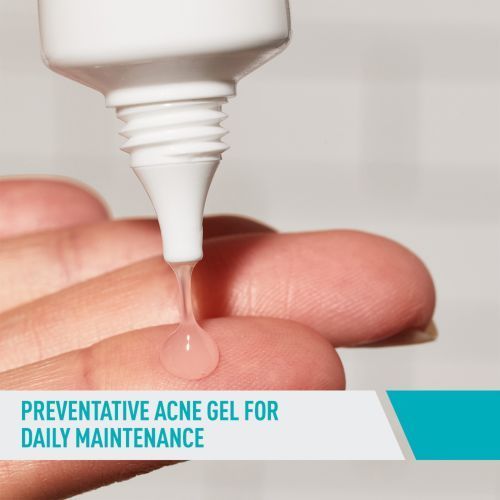 Salicylic Acid Acne Control Gel Treatment With, AHA/BHA Acne Treatment For Face,