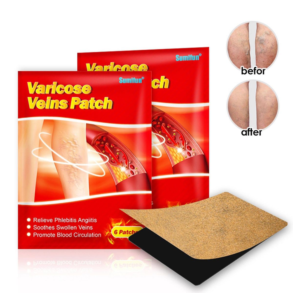 12Pcs Varicose Veins Plaster Varicosity Angiitis Back Leg Patch