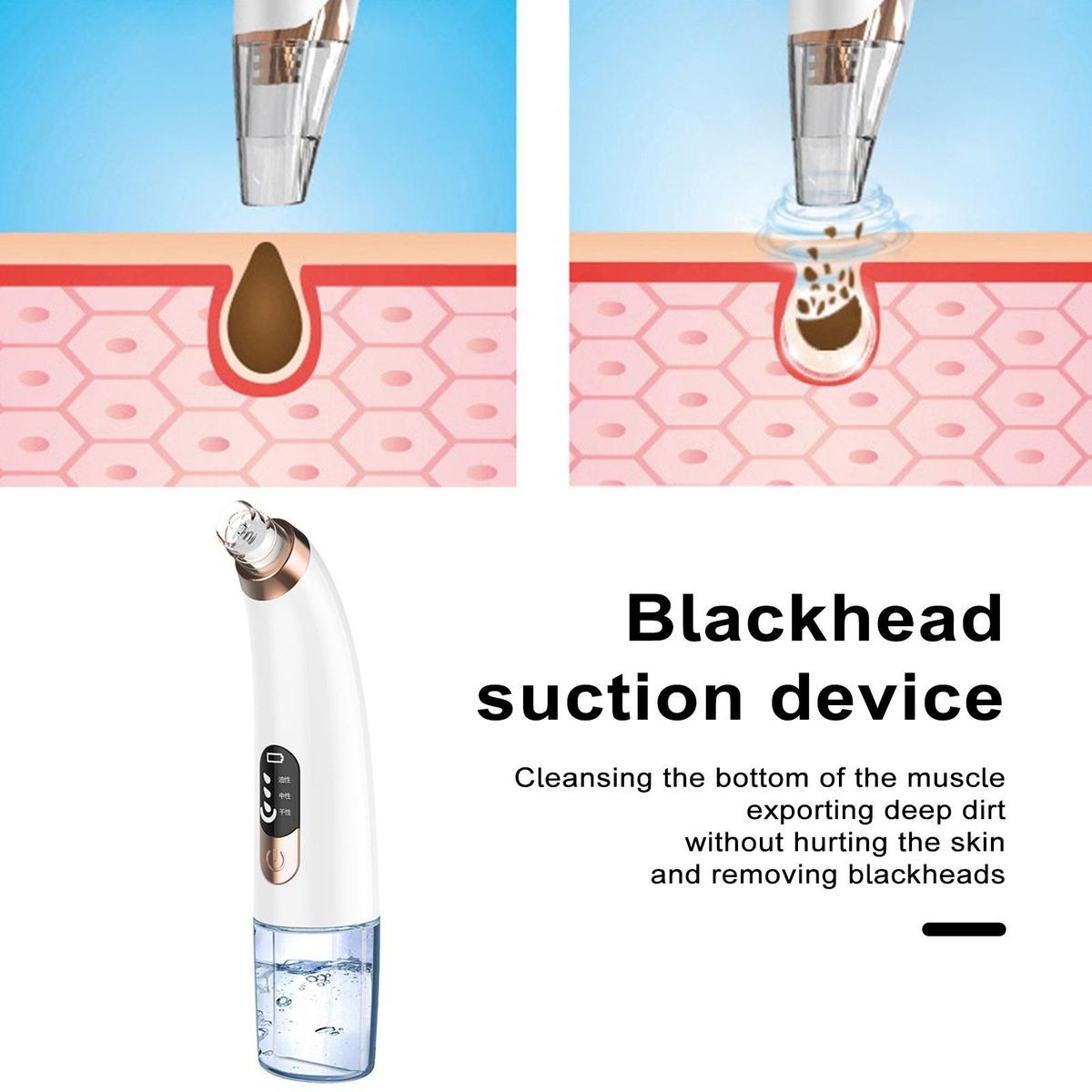 Acne Treatment Advanced Blackhead Remover Vacuum Rechargeable Pore C