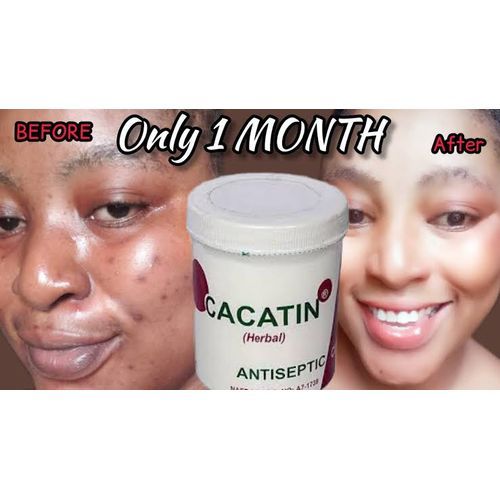 Cacatin Herbal Antiseptic Cream 20g