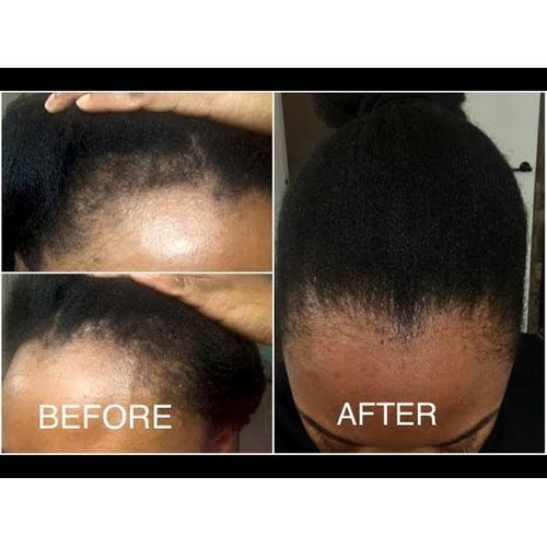 3 In1 Combo Super Hair Booster, Hair Growth Oil & Cream