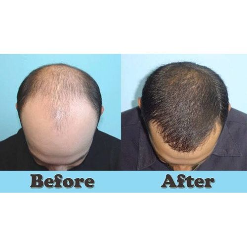 3 In1 Combo Super Hair Booster, Hair Growth Oil & Cream