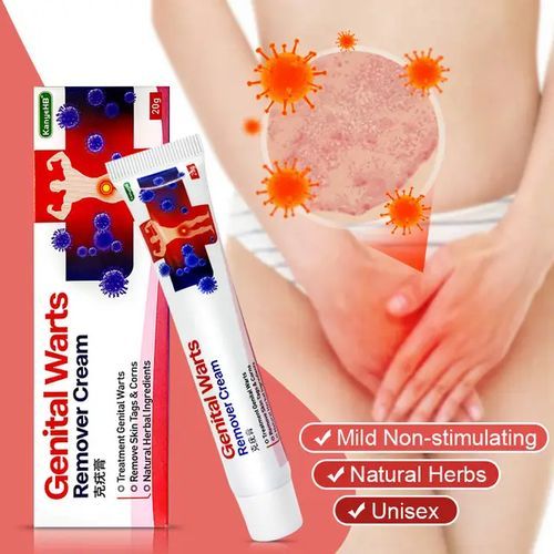 KanyeHB Genital Warts Removal Cream