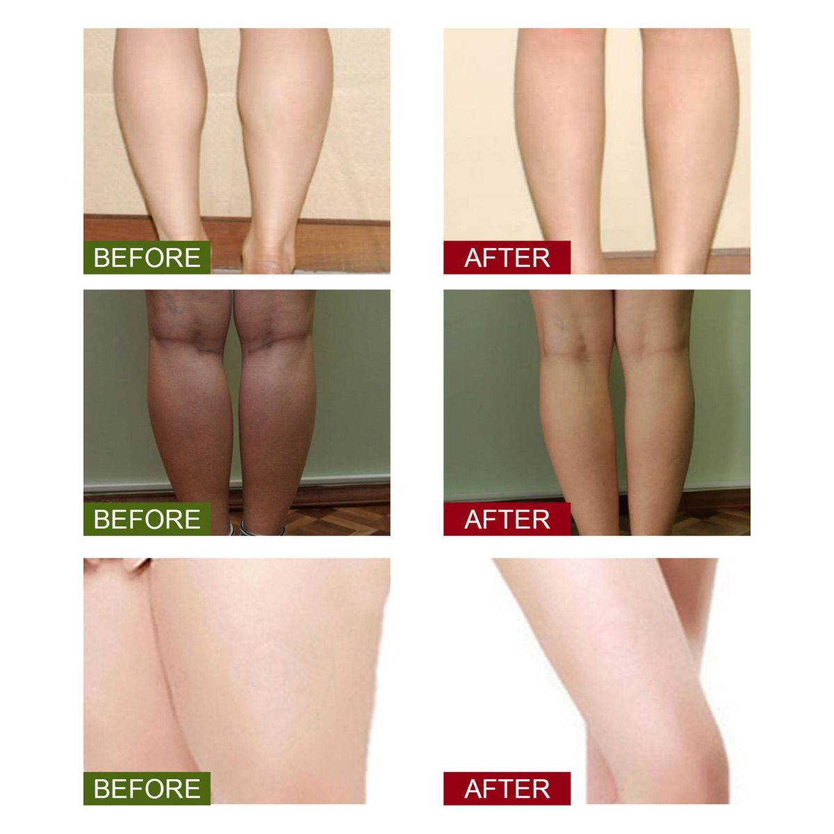 EELHOE 10Pcs Leg Slimming Foot Bath Bags Mild Herbal Formula Increase Blood Circulation Stimulate Detoxification Reduce Leg Edema