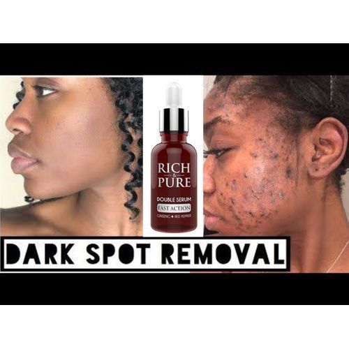 Rich & Pure Double Serum For Acne,