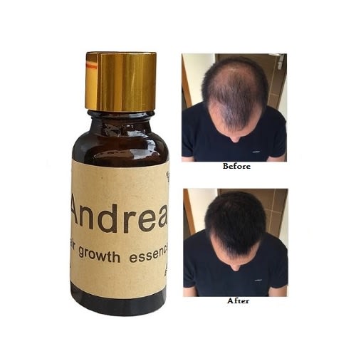 Fastest Hair & Beard Growth Essence - 20ml