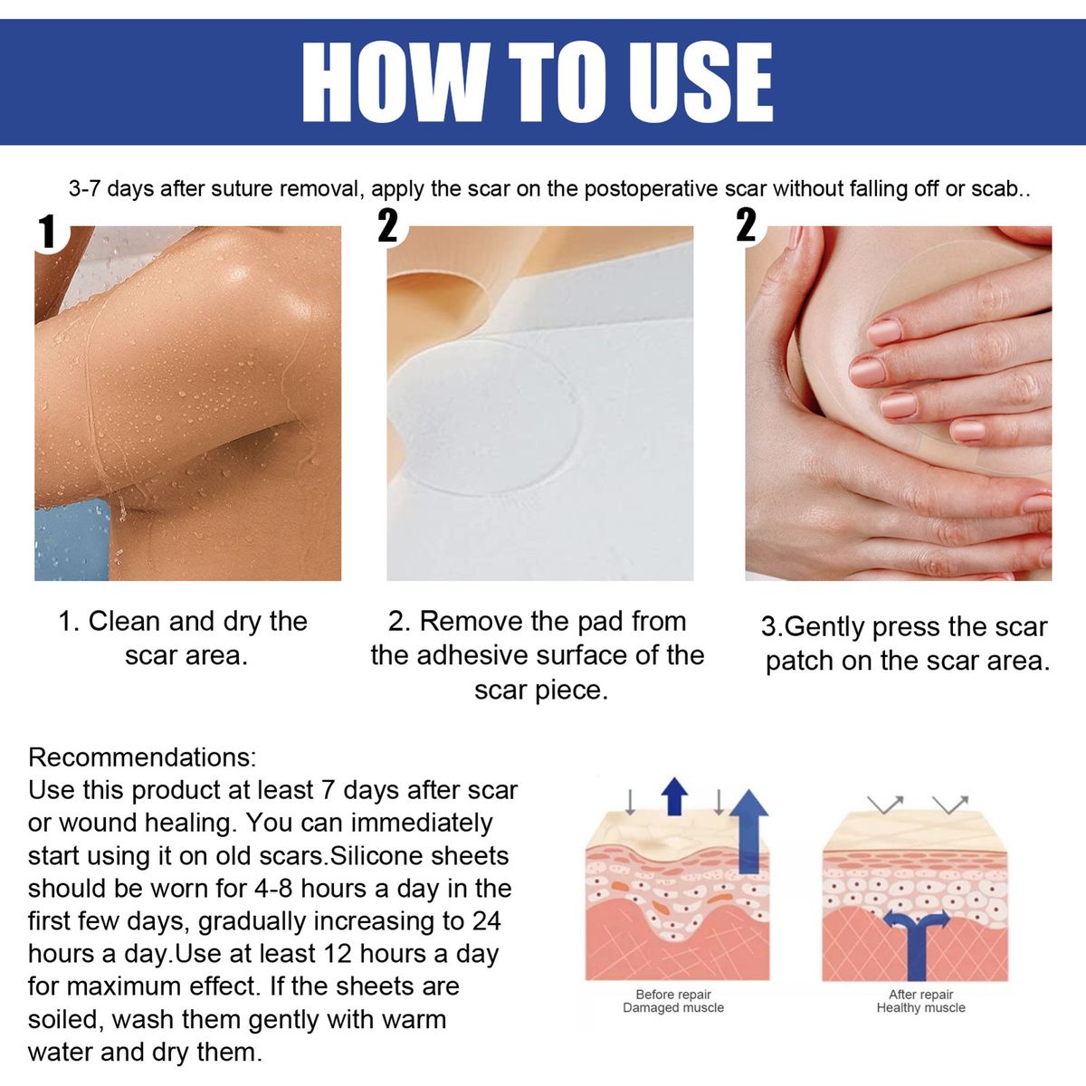 4 Pairs Breast Silicone Scar Sheets Safety Mild