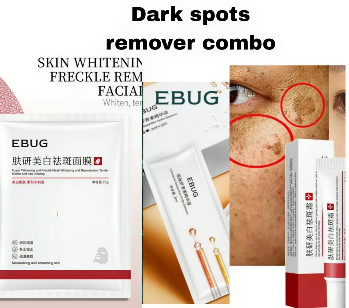 Sunburn, Dark Spots & Freckles Removal Cream + Sheet Mask + Astaxanthin Serum 2ml