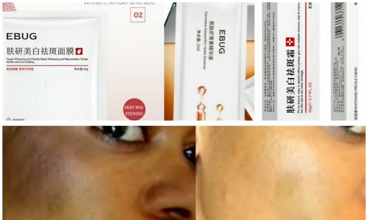 Sunburn, Dark Spots & Freckles Removal Cream + Sheet Mask + Astaxanthin Serum 2ml