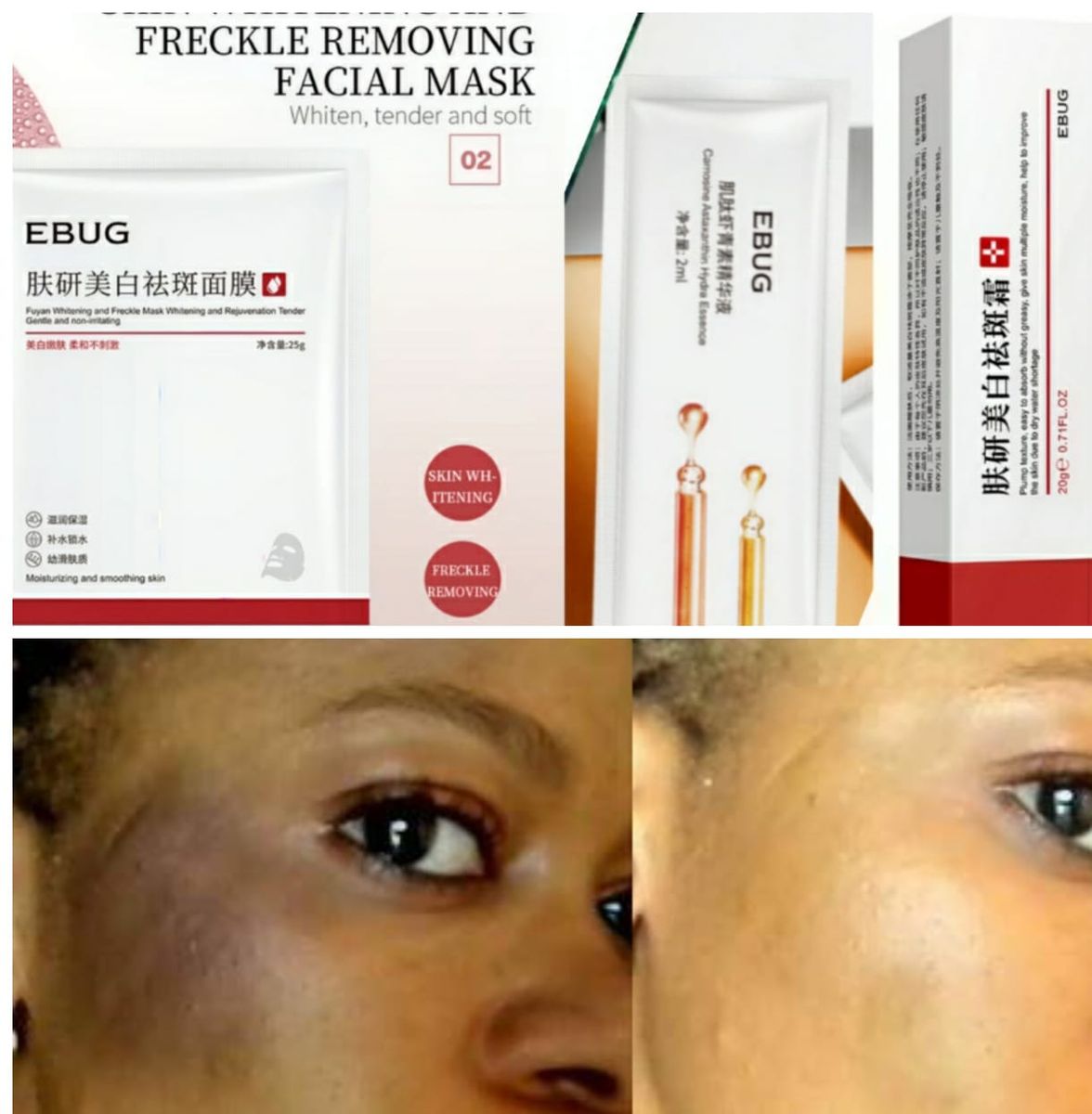 Sunburn, Dark Spots & Freckles Removal Cream + Sheet Mask + Astaxanthin Serum 2ml