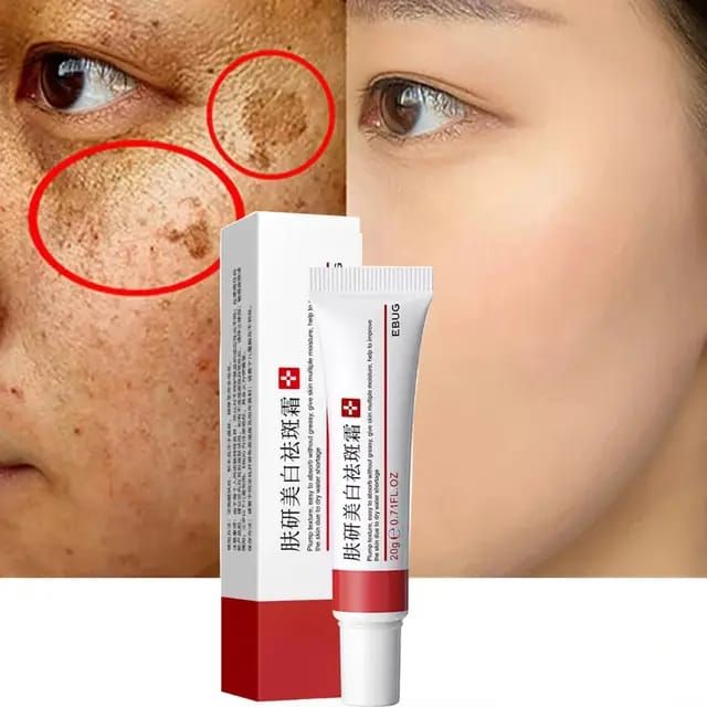Sunburn, Dark Spots & Freckles Removal Cream + Sheet Mask + Astaxanthin Serum 2ml