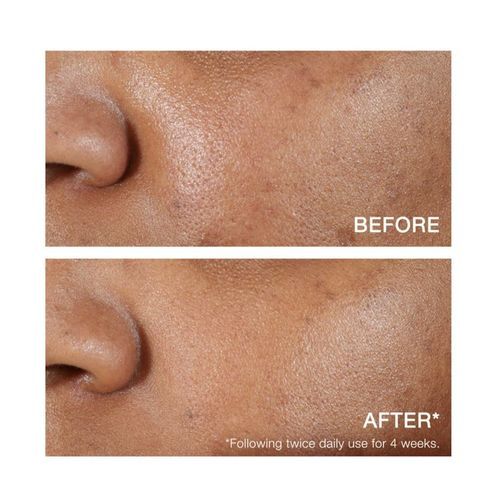 Hydro Boost Hyaluronic Acid Serum