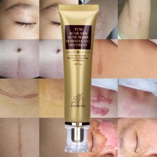 Lanbena Tcm Scar And Acne Mark Removal Gel Ointment Acne Scar Cream 30g