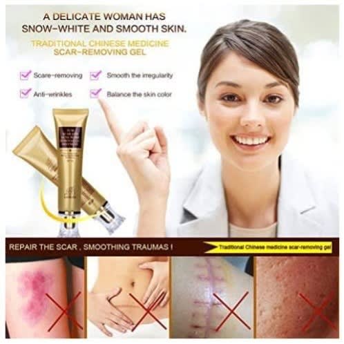 Lanbena Tcm Scar And Acne Mark Removal Gel Ointment Acne Scar Cream 30g