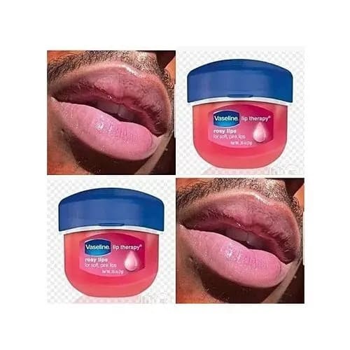 7 Days Pink Lips Balm -7g
