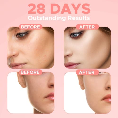 Envisha Strong Super Serum 4 In 1 Facial Serum For Anti Aging Wrinkles  Dark Circle - 30ml
