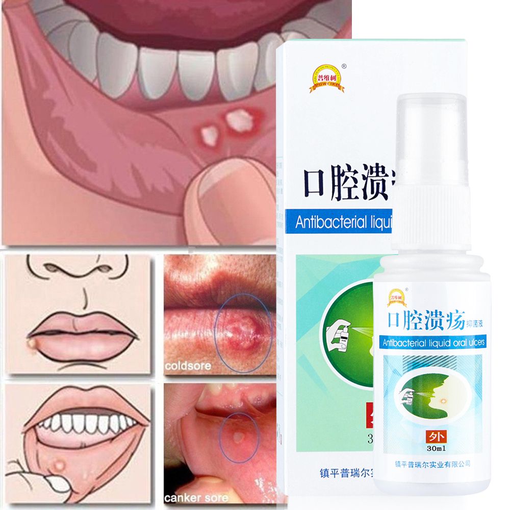 30ml Natural Herbal Mouth Ulcer Pain Relief Spray Anti Care