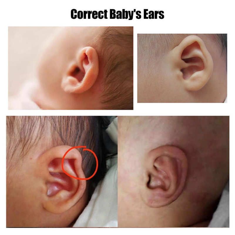 Silicone Kids Infant Protruding Ear Patch Stickers Newborn Baby Ear Aesthetic Cosmetic Ear Corrector Ear Care Correction Tape ACU
