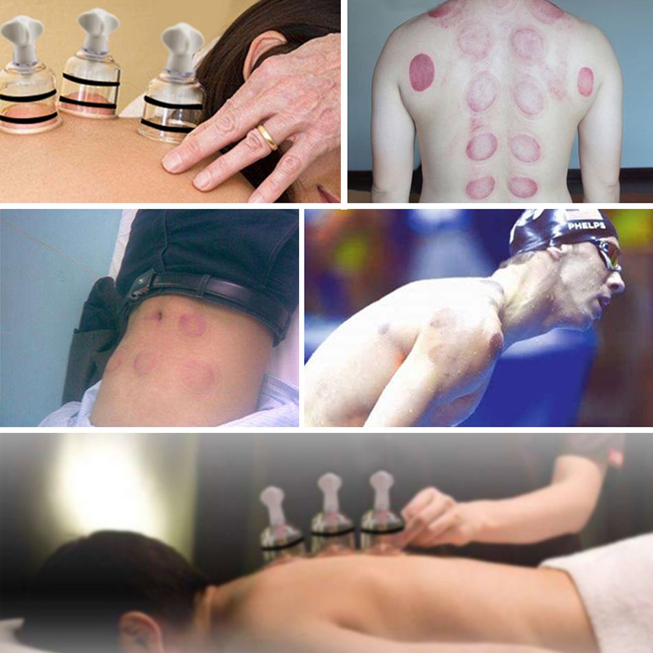 Twist Cupping Easy Body Enlarger Cups Plastic Suction Pieces Vacuum Suction Massage Fetish Nipple Enhancer 4 Set Enlarger