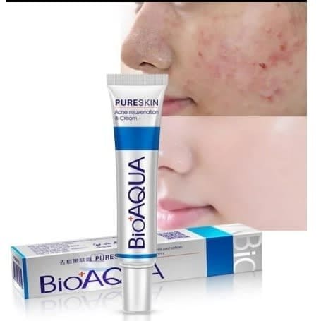 Bioaqua- Acne Removal And Smoothing Cream - 30g
