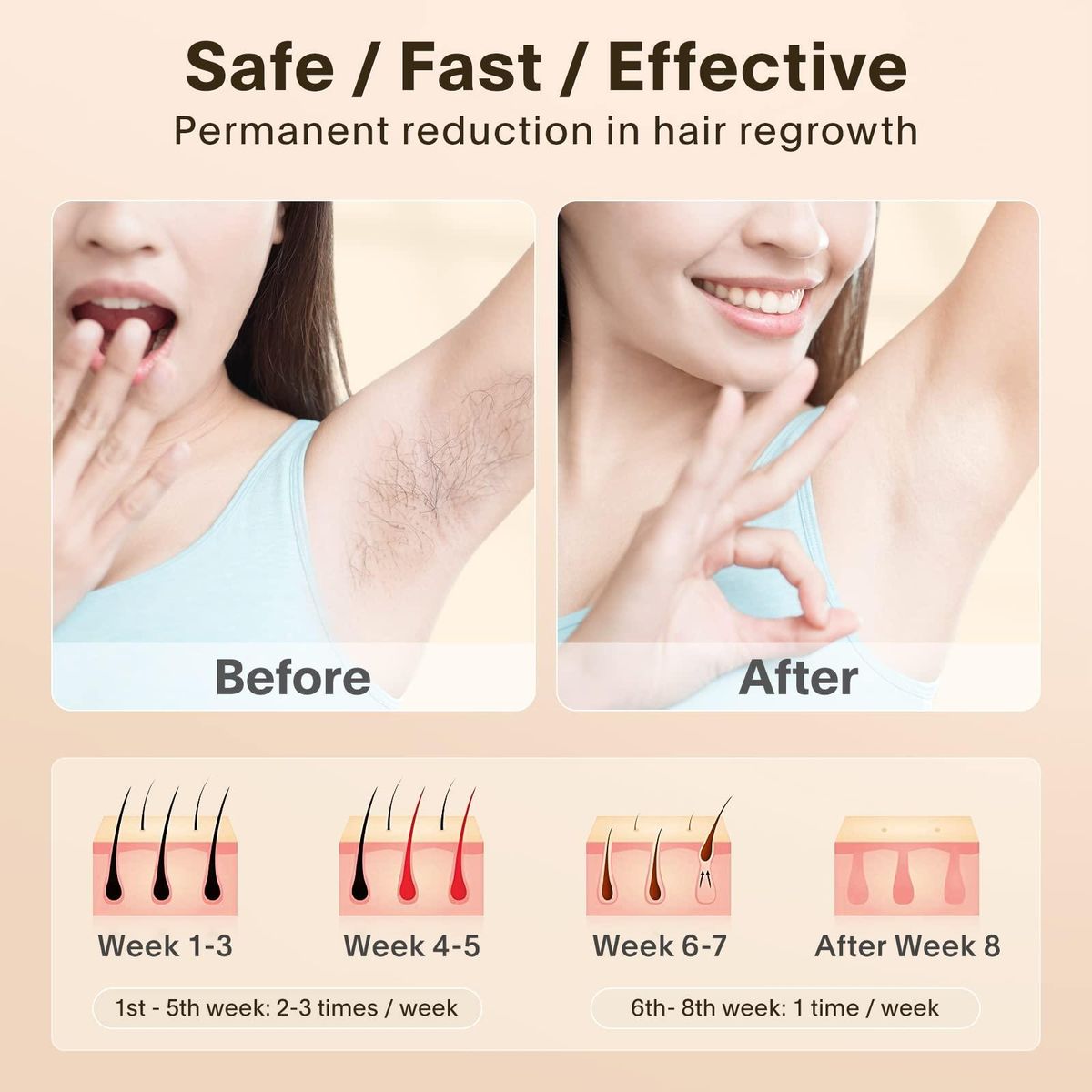Laser Hair Removal for Women and Man Hair Remover Device Professional Hair Removal For Facial Body At-Home Upgraded to 999,999 Permanent Flashes