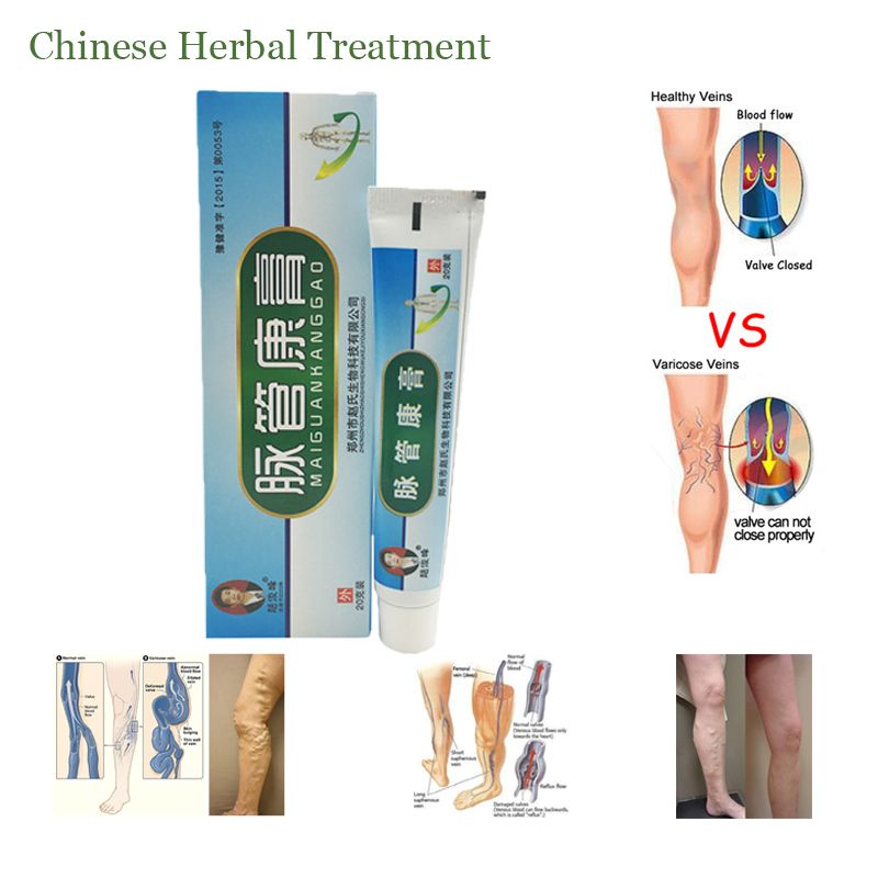Vasculitis Leg Plaster Anti Phlebitis Product Foot Varicose Varicosity Cream Medical Medical Veins Herbal Treatment