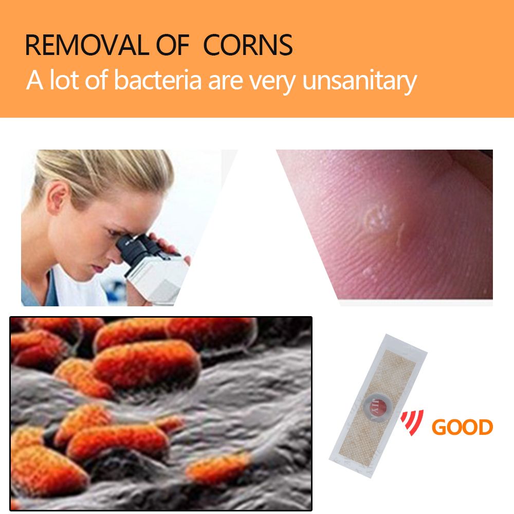 Feet Patch Corn Callus Tool Medical Warts Thorn Care Foot Painless Feet Hot Soften Care Removal 40Pcs Remover C584 Plaster Skin