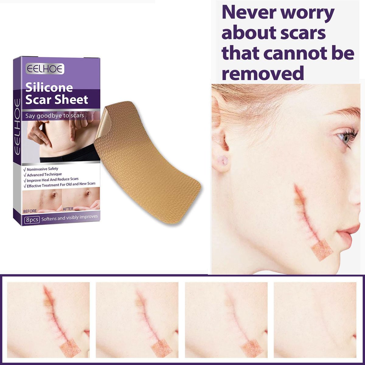 Silicone  Sheet  Tape Professional Repairs  Scars