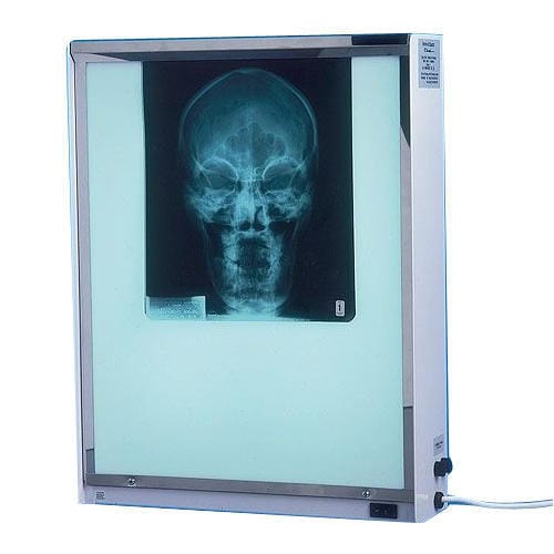 Xray Viewing Box (single)
