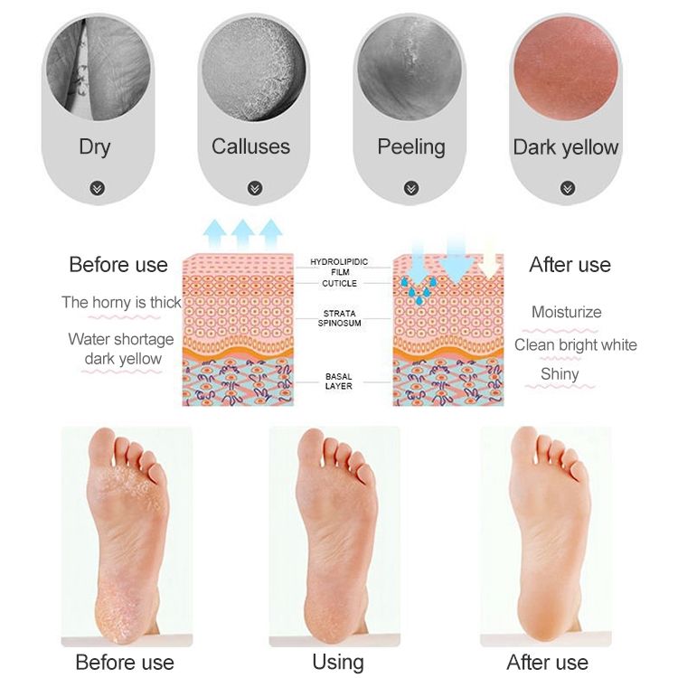 Silicone Sailboat Socks Foot Heel Anti-cracking Sleeve Anti-drying Beach Home Socks, Size:L(39-41)(Skin Color)