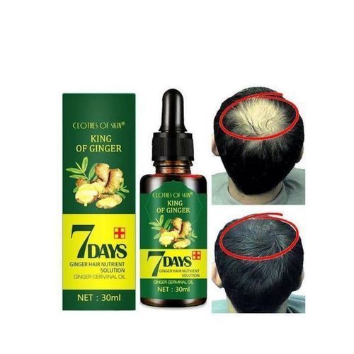 Ginger Germinal Oil/Anti Hair Loss & Bald Head Serum