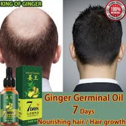 King Of Ginger 7 Days Ginger Hair Growth Oil 30ML