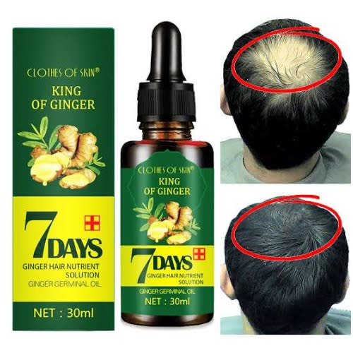 Clothes Of Skin King Of Ginger 7 Days Hair Nutrient Solution Oil - 30ml