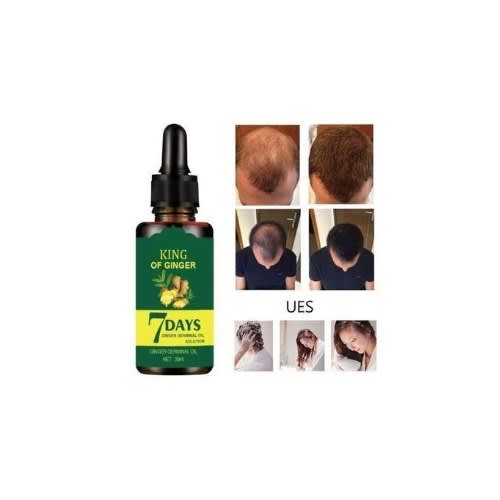 King Of Ginger - 7days Ginger Germination Hair Growth Oil - 30ml