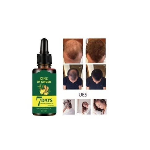 King Of Ginger - 7days Ginger Germination Hair Growth Oil - 30ml
