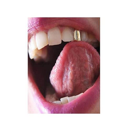 Gold Teeth Grillz -1 Piece