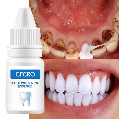 Teeth Whitener Essence