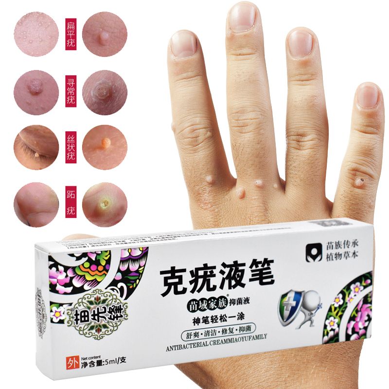 Papillomas Removing Removal Remedy Warts Moles Tags Treatment Skin Verruca 1pc Liquid Anti Of Wart Genital Against Remover From