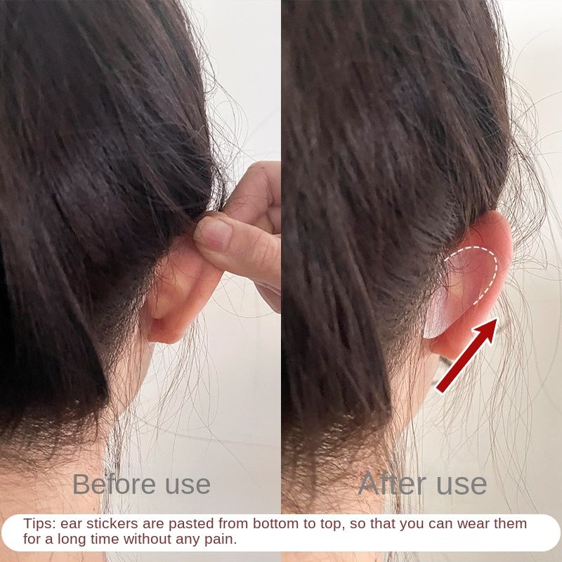 Elf Ear Stickers Veneer Ears Become Ear Correction Vertical Stand Ear Stickers Photo Stereotyp WJ