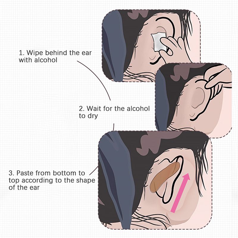 Elf Ear Stickers Veneer Ears Become Ear Correction Vertical Stand Ear Stickers Photo Stereotyp WJ