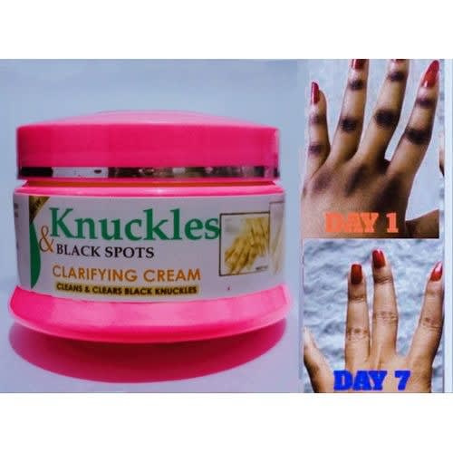 Dark Knuckles/Dark Spots Repair Hand Cream - 150ml